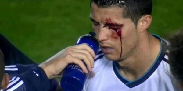 华体育会app(中国)官方网站-莱万特旧将：我过去曾无意肘击C罗，媒体却几乎要把我关进监狱